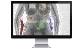 xray_1318111524